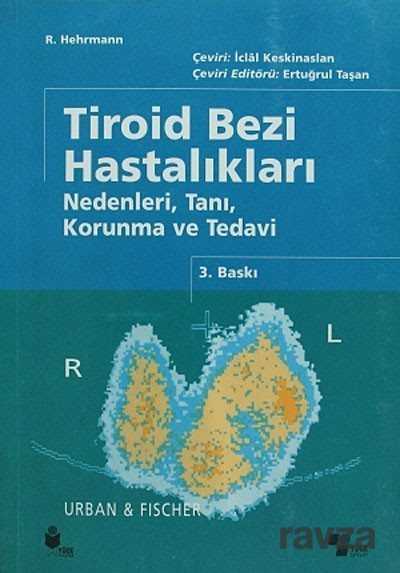 Tiroid Bezi Hastalıkları Nedenleri, Tanı, Korunma ve Tedavi - Yüce Yayınları