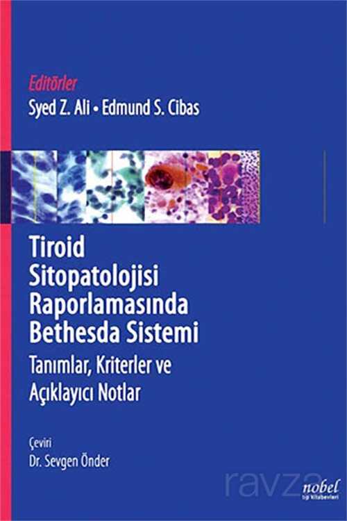 Tiroid Sitopatolojisi Raporlamasında Bethesda Sistemi: Tanımlar, Kriterler ve Açıklayıcı Notlar - Nobel Tıp Kitabevleri