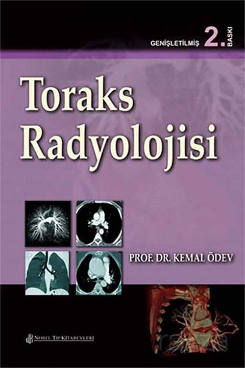 Toraks Radyolojisi - Nobel Tıp Kitabevleri
