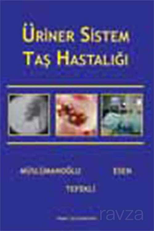 Üriner Sistem Taş Hastalıkları - Nobel Tıp Kitabevleri