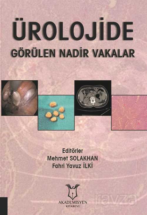 Ürolojide Görülen Nadir Vakalar - 1