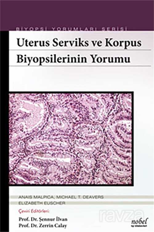 Uterus Serviks ve Korpus Biyopsilerinin Yorumu - Biyopsi Yorumları Serisi - 1